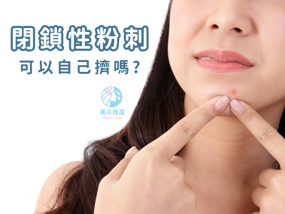 閉鎖性粉刺