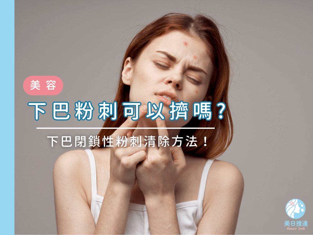 下巴粉刺